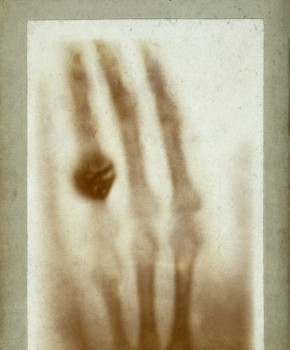 Look Closer 4eme: Lucky mistakes: The X-ray, episode sheets - Exercises public_resources.teaching_resource
